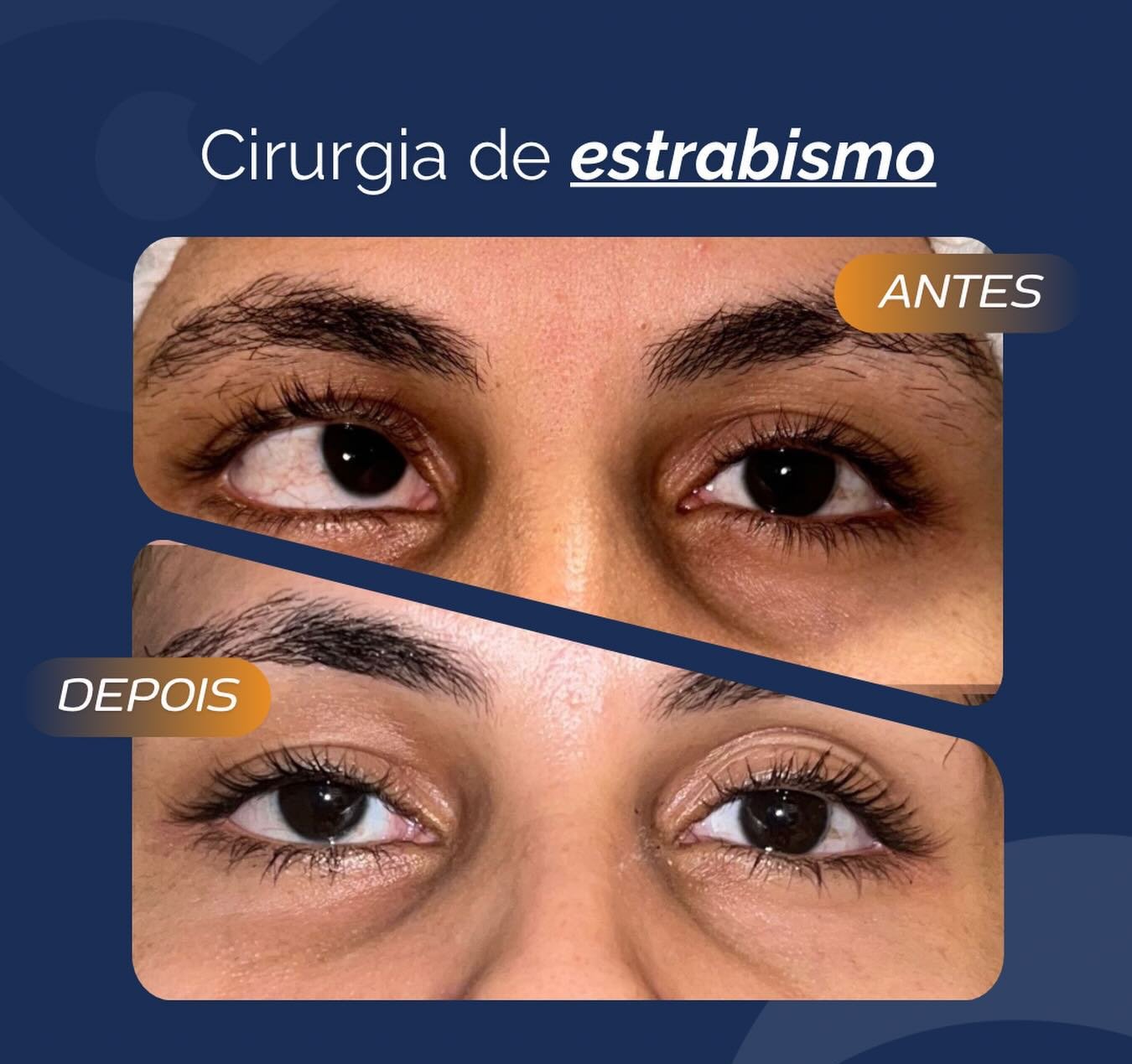 SaveClip.App_728240453_17911040196424979_7713948174379171207_n (1)